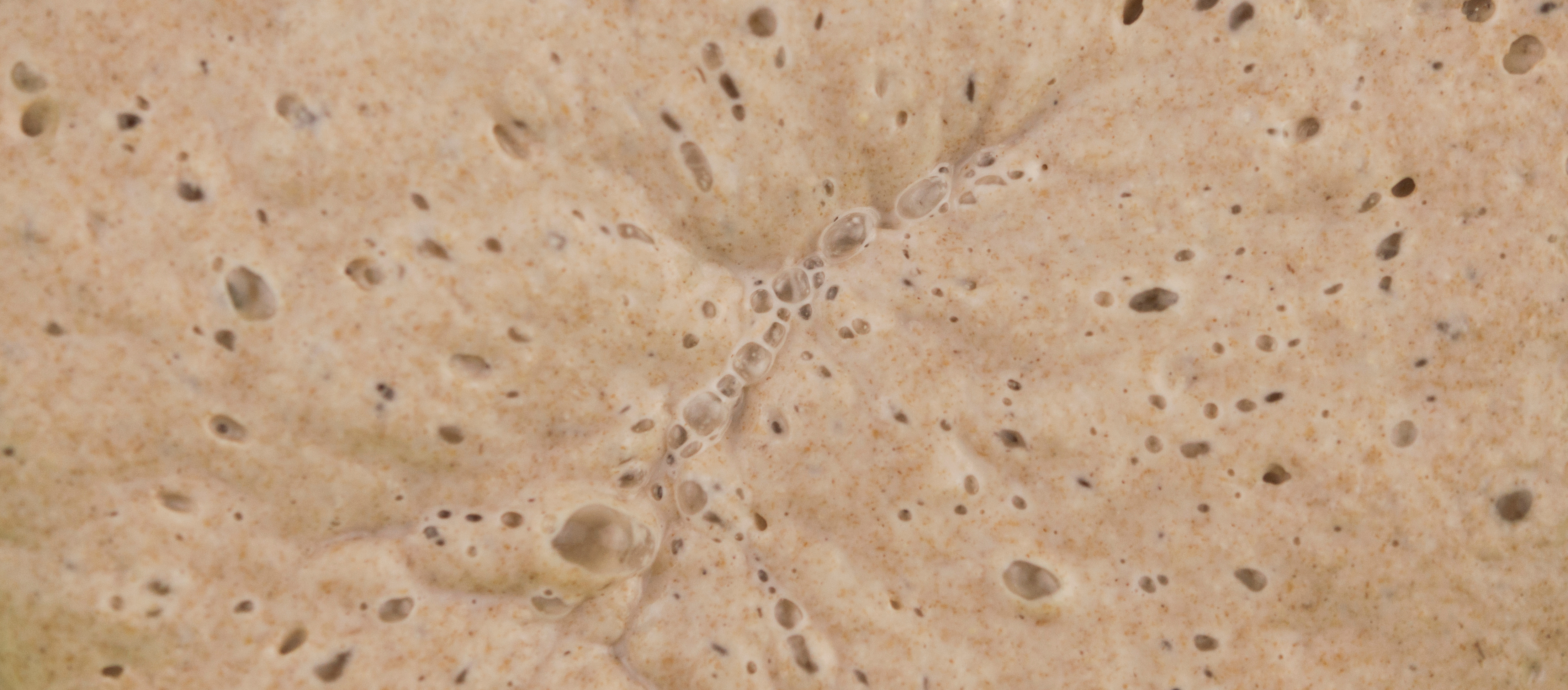 Beta-Glucane und Mannane aus Hefe – unsichtbare Helfer in Ihrer Ernährung